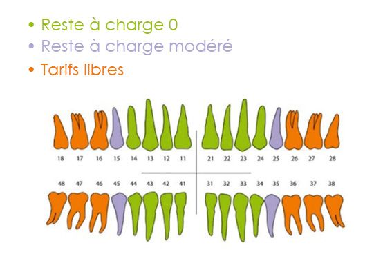 Prothese Dentaire Zero Reste A Charge  : Les Prothèses Dentaires Ont Pour But De Restaurer Une Dent Ou De Remplacer Une Ou Plusieurs Dents Manquantes.